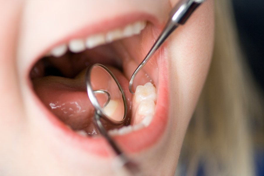 Clinic helps those who cant afford regular dentist visits in Santa Fe [Video]
