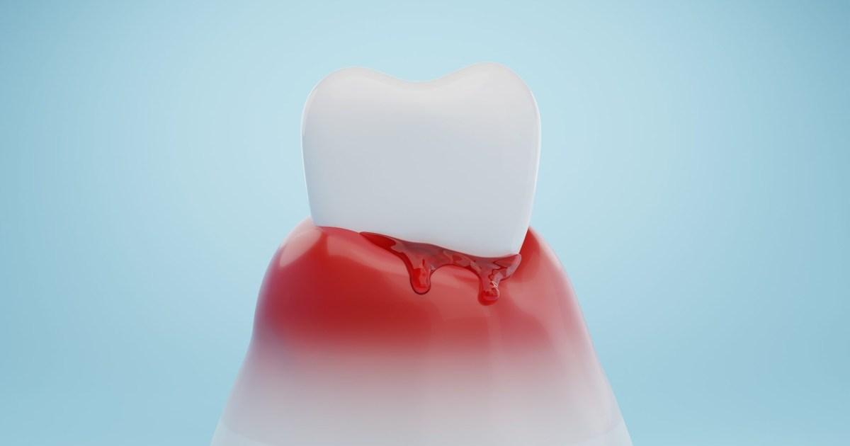 Gum disease can wreak havoc on your sexual health [Video]