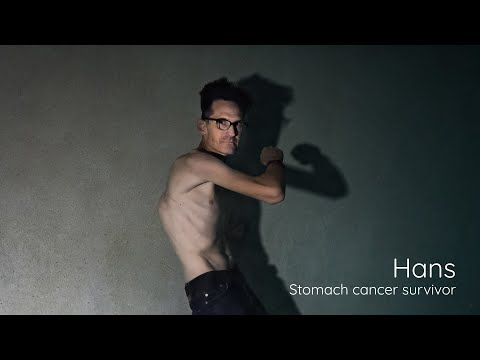 Hans – Stomach cancer survivor [Video]