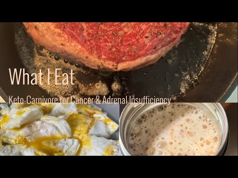 What I Eat – Keto/Carnivore for Cancer & Adrenal Insufficiency [Video]