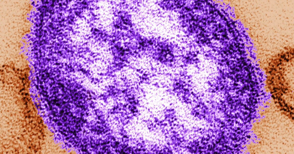Health officials alert residents about possible measles exposure in 2 states [Video]