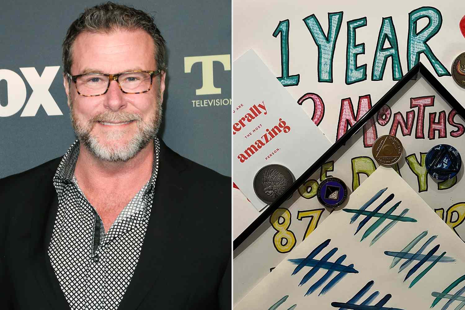 Dean McDermott Celebrates 1 Year of Sobriety: ‘A Beautiful Life Awaits’ [Video]